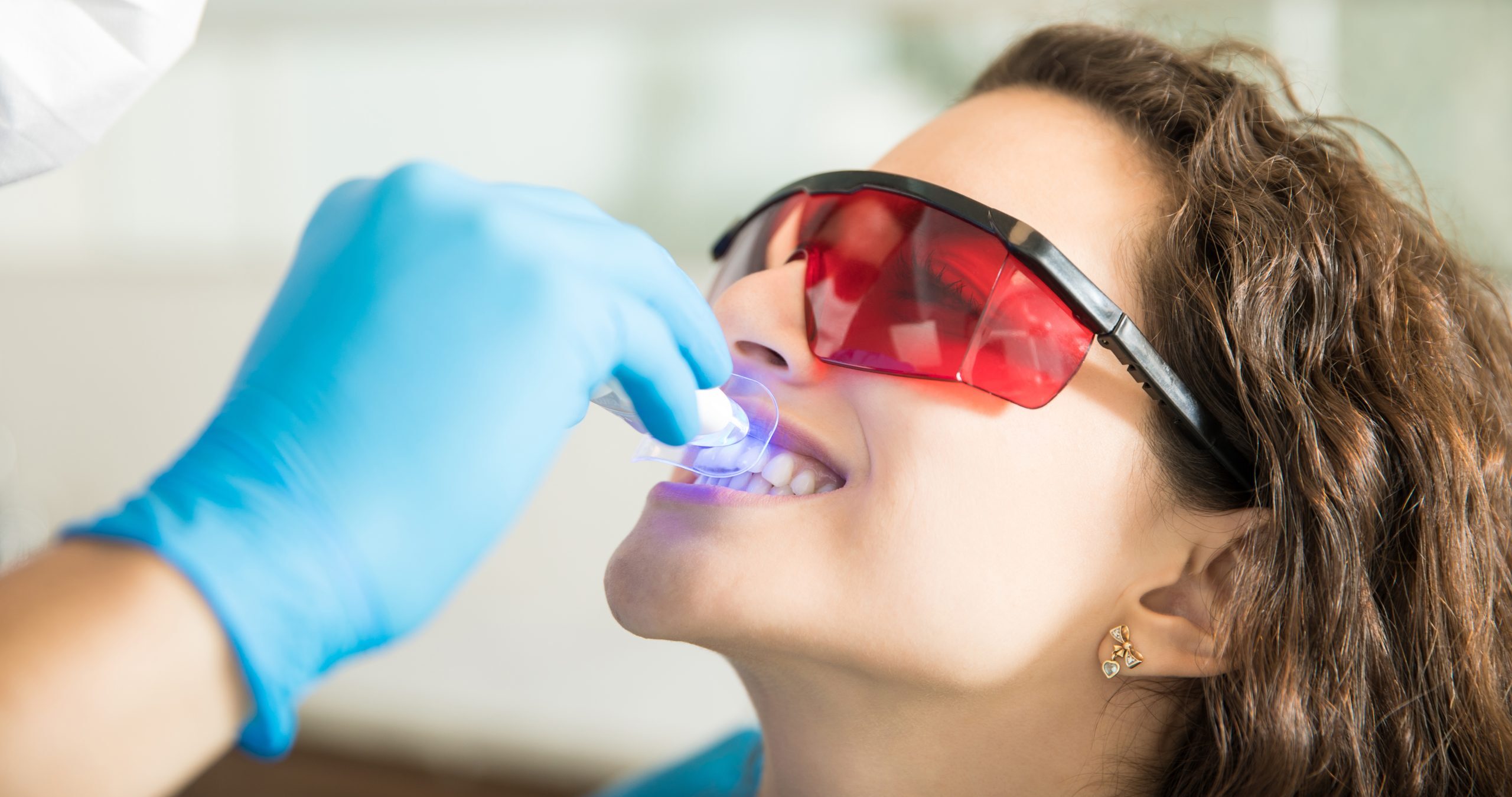 Teeth Whitening in Mexico A Bright and Affordable Dental Solution