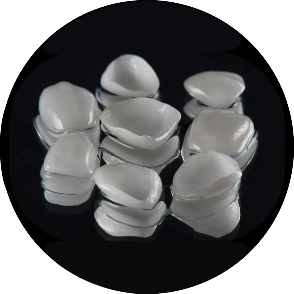 Dental Veneers in Mexico MexicoDent Pricelist