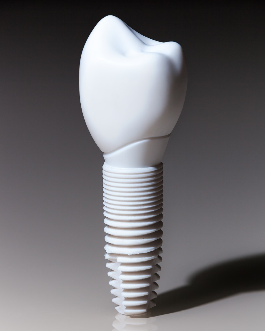 Zirconia Dental Implants Cost In Mexico